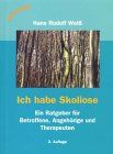 Ich habe Skoliose