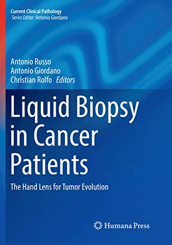 Liquid Biopsy in Cancer Patients: The Hand Lens for Tumor Evolution (Current Clinical Pathology)