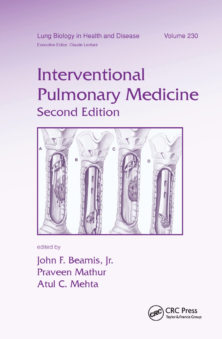 Interventional Pulmonary Medicine (Lung Biology in Health and Disease, Band 230)