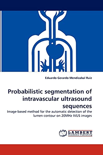 Probabilistic segmentation of intravascular ultrasound sequences: Image-based method for the automatic detection of the lumen contour on 20MHz IVUS images