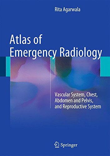 Atlas of Emergency Radiology: Vascular System, Chest, Abdomen and Pelvis, and Reproductive System