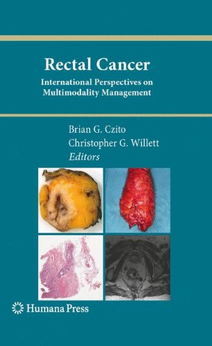 Rectal Cancer: International Perspectives on Multimodality Management (Current Clinical Oncology)