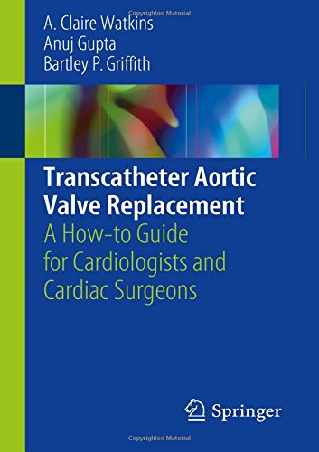 Transcatheter Aortic Valve Replacement: A How-to Guide for Cardiologists and Cardiac Surgeons
