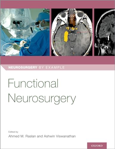 Functional Neurosurgery (Neurosurgery by Example)