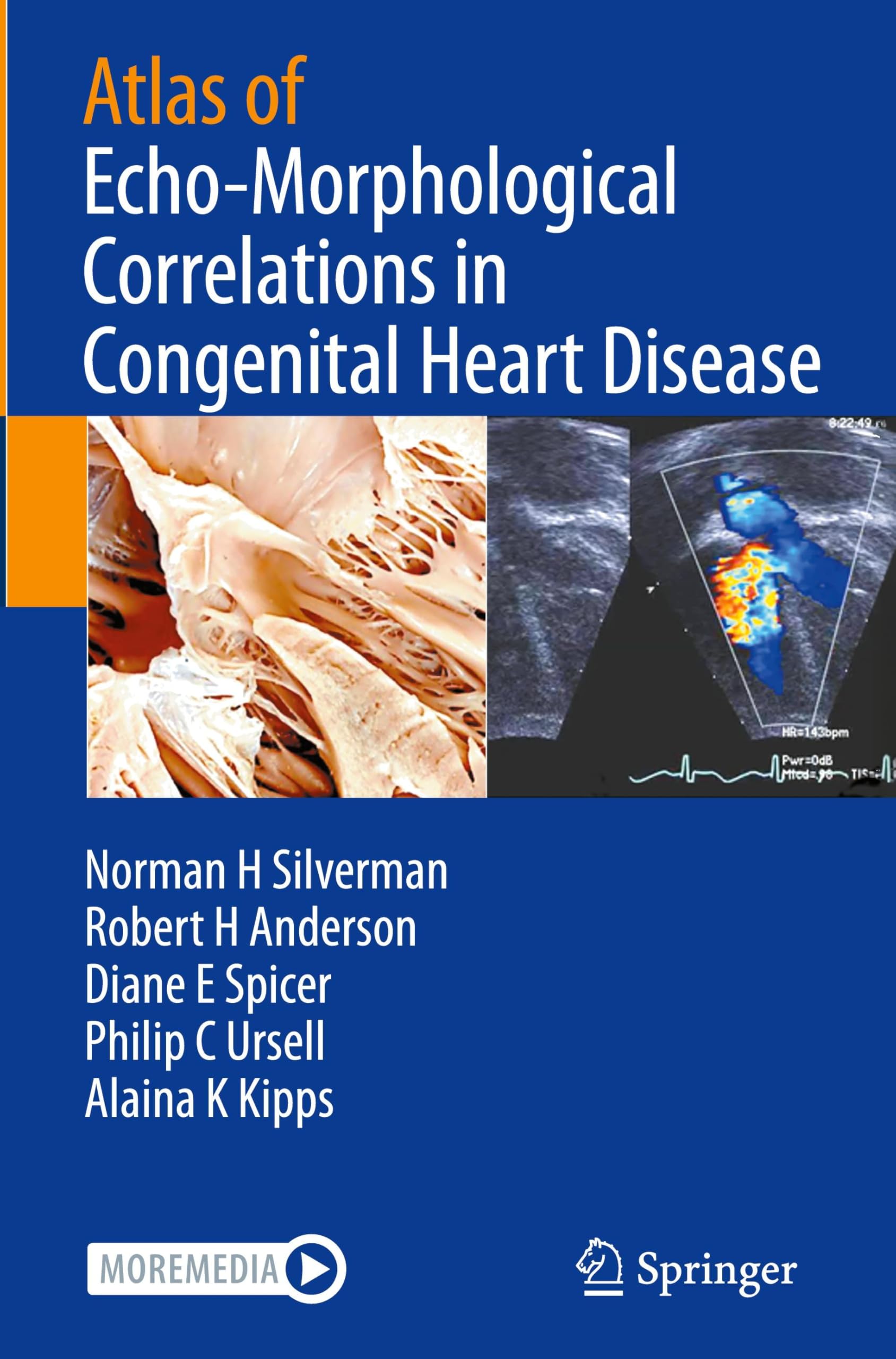 Atlas of Echo-Morphological Correlations in Congenital Heart Disease
