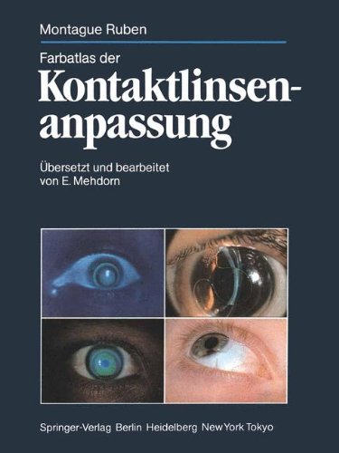 Farbatlas der Kontaktlinsenanpassung