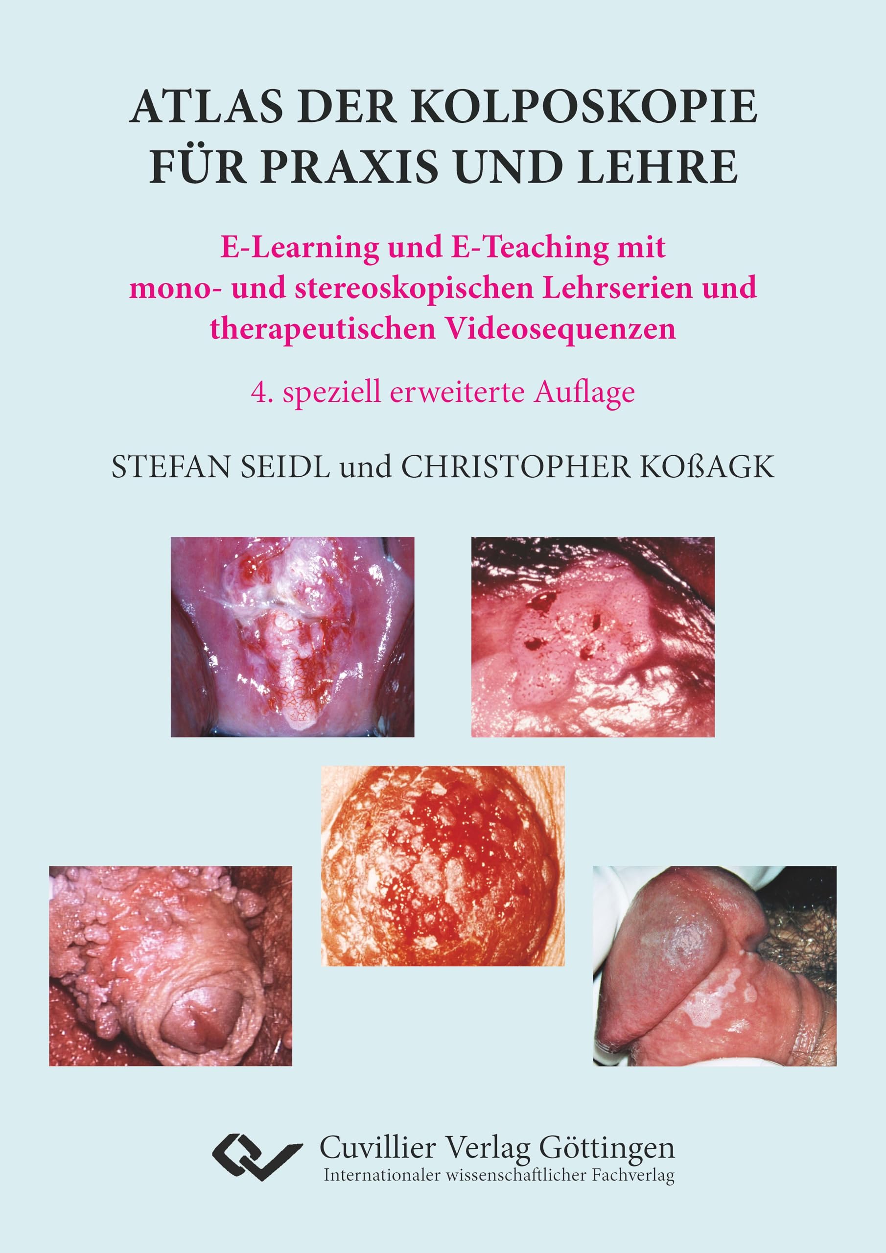 Atlas der Kolposkopie für Praxis und Lehre: E-Learning und E-Teaching mit mono- und stereoskopischen Lehrserien und therapeutischen Videosequenzen