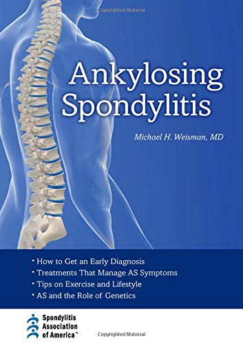 Ankylosing Spondylitis