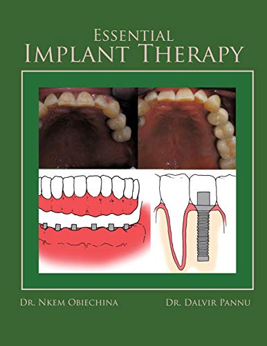 Essential Implant Therapy: A Patient's guide to understanding Implant dentistry
