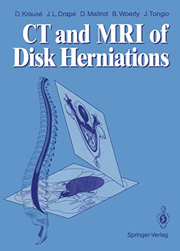C.T. and M.R.I. of Disk Herniations