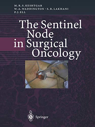 The Sentinel Node in Surgical Oncology