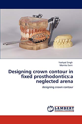Designing crown contour in fixed prosthodontics:a neglected arena: designing crown contour