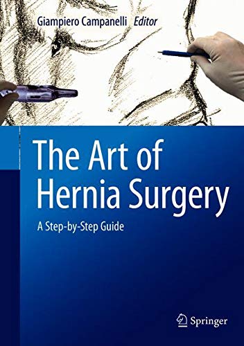 The Art of Hernia Surgery: A Step-by-Step Guide