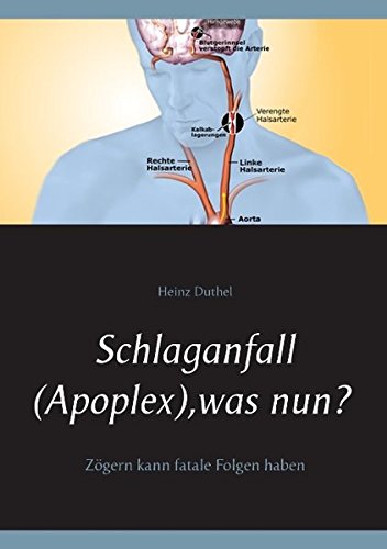 Schlaganfall (Apoplex), was nun?: Zögern kann fatale Folgen haben