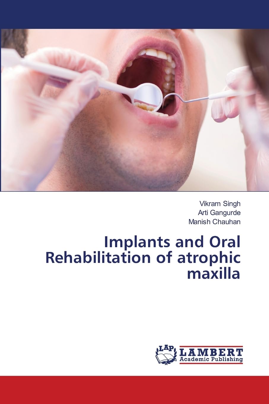 Implants and Oral Rehabilitation of atrophic maxilla: DE