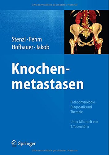 Knochenmetastasen: Pathophysiologie, Diagnostik und Therapie - Unter Mitarbeit von T. Todenhöfer