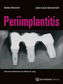 Periimplantitis von Stefan Renvert, Jean-Louis Giovannoli | Buch | Zustand sehr gut