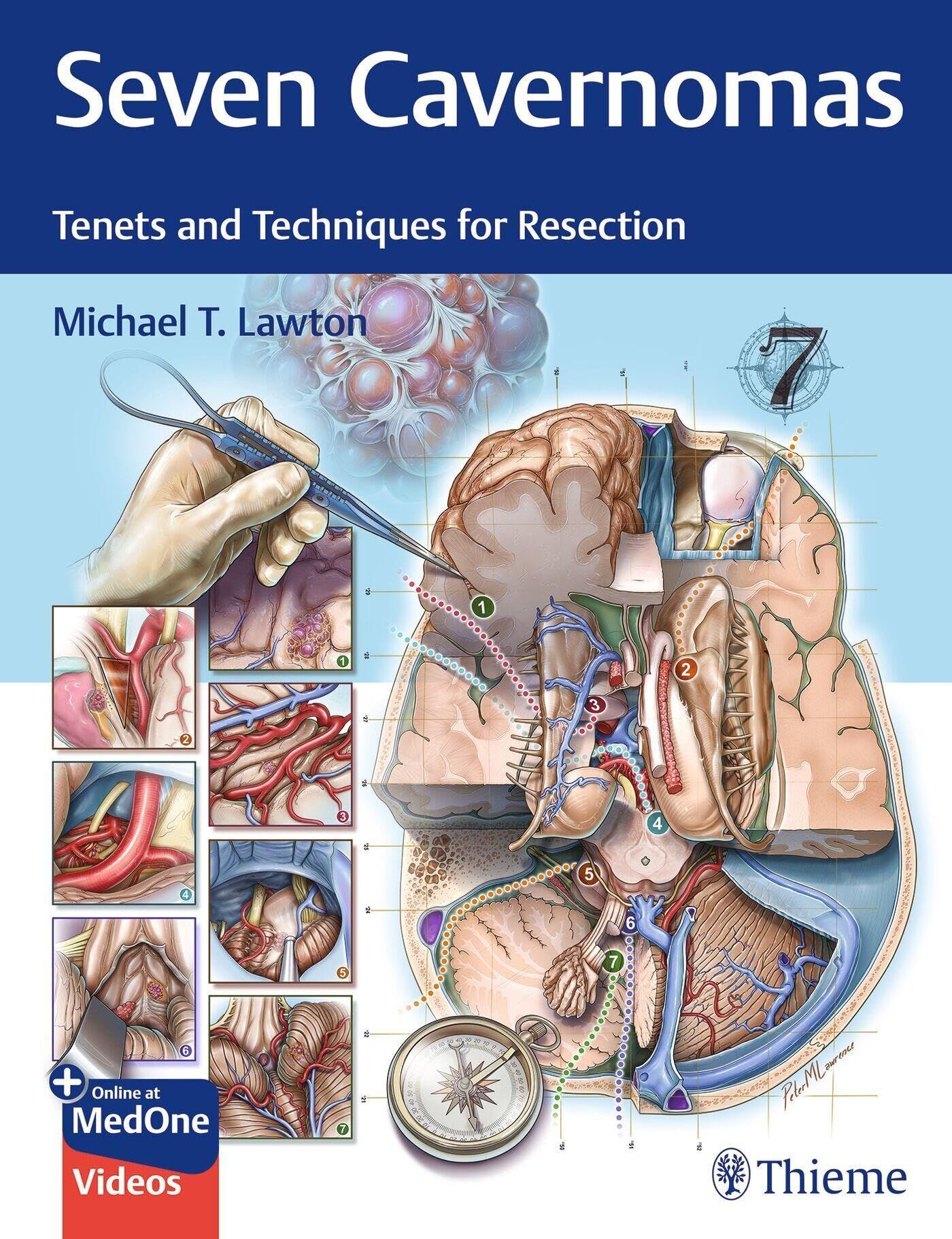 Lawton, Michael T.: Seven Cavernomas