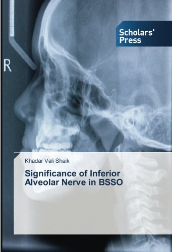 Significance of Inferior Alveolar Nerve in BSSO