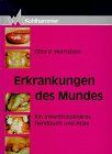 Erkrankungen des Mundes