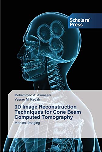 3D Image Reconstruction Techniques for Cone Beam Computed Tomography: Medical Imaging