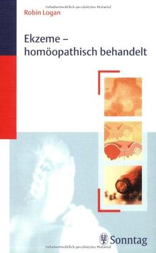 Ekzeme - homöopathisch behandelt: Hilfe bei hartnäckigen Hauterkrankungen