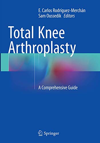 Total Knee Arthroplasty: A Comprehensive Guide