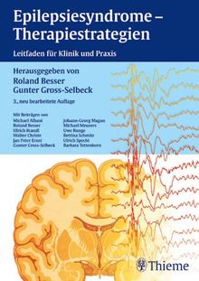 Epilepsiesyndrome - Therapiestrategien. Leitfaden für Klinik und Praxis