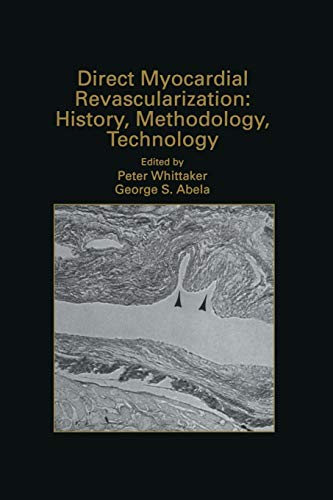 Direct Myocardial Revascularization: History, Methodology, Technology (Developments in Cardiovascular Medicine) (Developments in Cardiovascular Medicine, 211, Band 211)