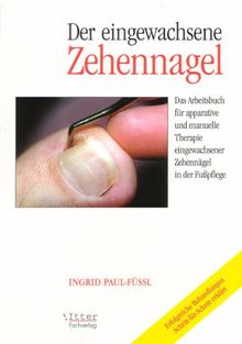 Der eingewachsene Zehennagel " Das Arbeitsbuch für apparative und manuelle Therapie eingewachsener Zehennägel in der Fußpflege"