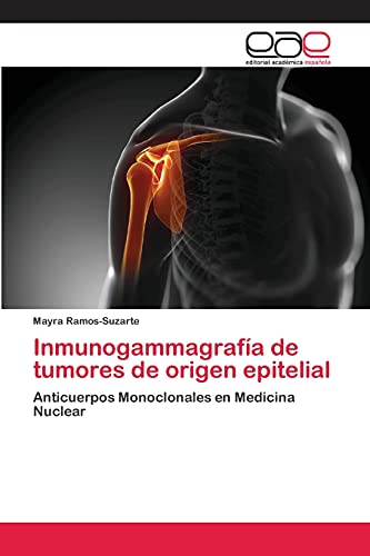 Inmunogammagrafía de tumores de origen epitelial: Anticuerpos Monoclonales en Medicina Nuclear