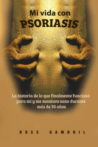 Mi vida con PSORIASIS: La historia de lo que finalmente funcionó para mí y me mantuvo claro durante más de 30 años