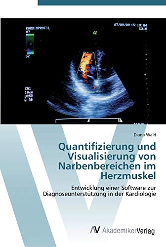 Quantifizierung und Visualisierung von Narbenbereichen im Herzmuskel: Entwicklung einer Software zur Diagnoseunterstützung in der Kardiologie