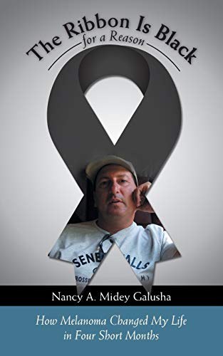 The Ribbon Is Black for a Reason: How Melanoma Changed My Life in Four Short Months
