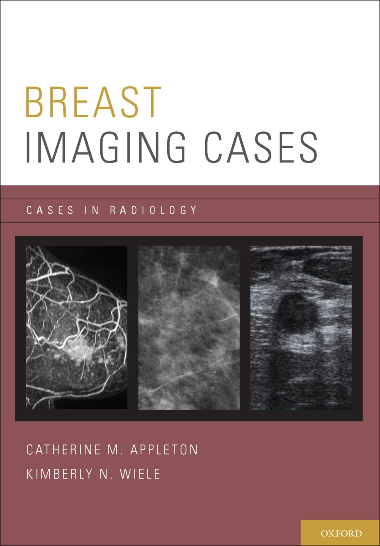 BREAST IMAGING CASES CASRAD P (Cases in Radiology)