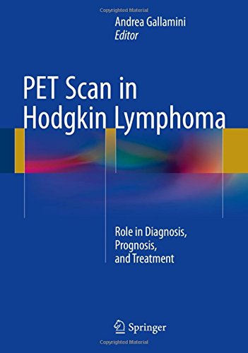 PET Scan in Hodgkin Lymphoma: Role in Diagnosis, Prognosis, and Treatment