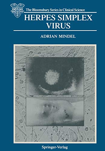 Herpes Simplex Virus (The Bloomsbury Series in Clinical Science)