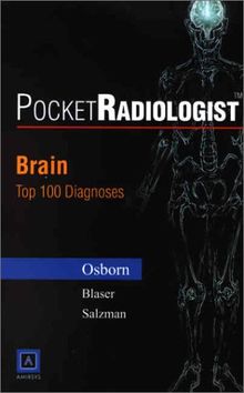 Brain: Top 100 Diagnoses (Pocket Radiologist)