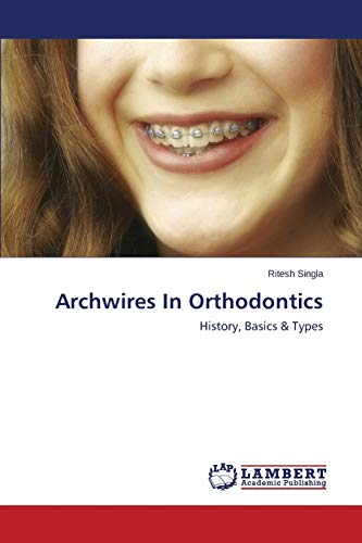 Archwires In Orthodontics: History, Basics & Types