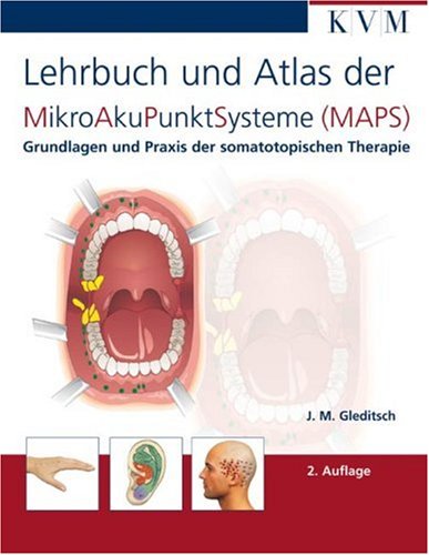 Gleditsch, Jochen M.: Mikro-Aku-Punkt-Systeme