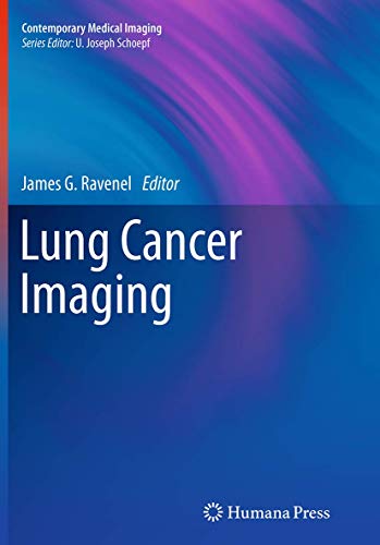 Lung Cancer Imaging (Contemporary Medical Imaging)