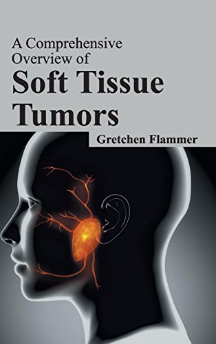 A Comprehensive Overview of Soft Tissue Tumors