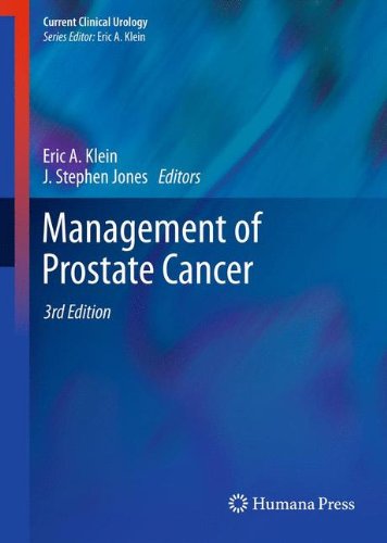 Management of Prostate Cancer (Current Clinical Urology)