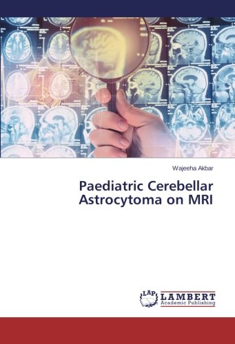 Paediatric Cerebellar Astrocytoma on MRI
