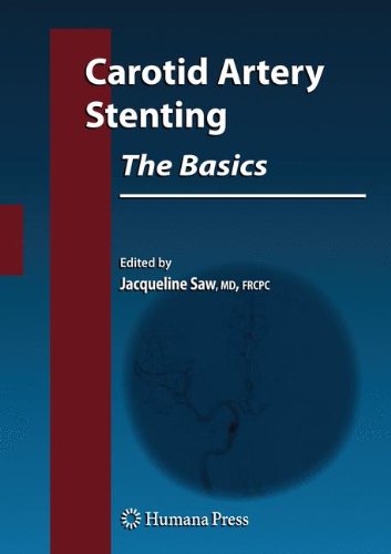 Carotid Artery Stenting: The Basics: The Basics - How to Set Up and Maintain a Cath Lab (Contemporary Cardiology)