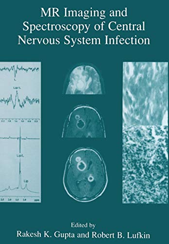 MR Imaging and Spectroscopy of Central Nervous System Infection