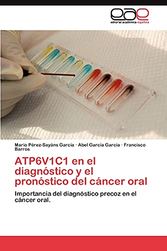 ATP6V1C1 en el diagnóstico y el pronóstico del cáncer oral: Importancia del diagnóstico precoz en el cáncer oral.