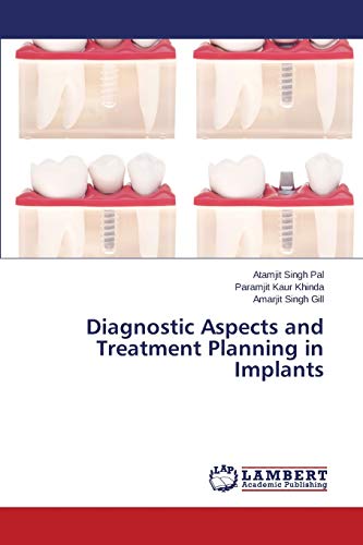 Diagnostic Aspects and Treatment Planning in Implants
