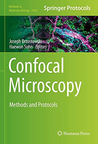 Confocal Microscopy: Methods and Protocols (Methods in Molecular Biology, 2304, Band 2304)