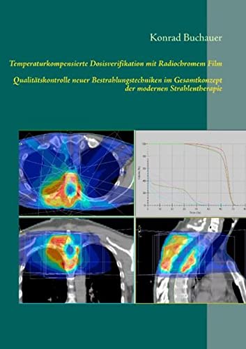 Temperaturkompensierte Dosisverifikation mit Radiochromem Film: Qualitätskontrolle neuer Bestrahlungstechniken im Gesamtkonzept der modernen Strahlentherapie